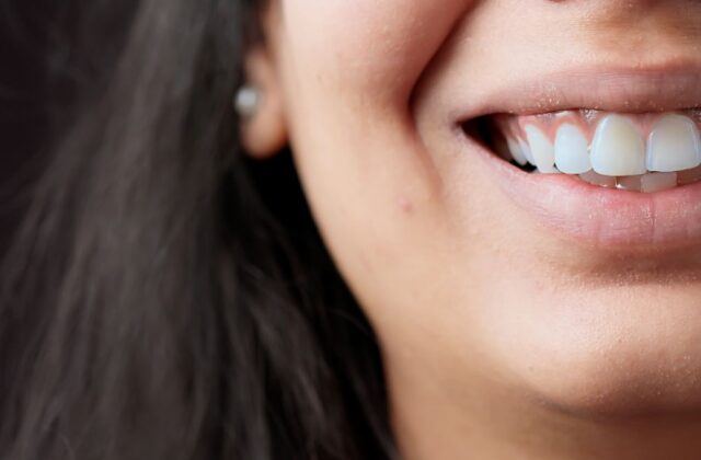 Close-up of a person's smile, showing white teeth and pink lips in a bright, cheerful expression.