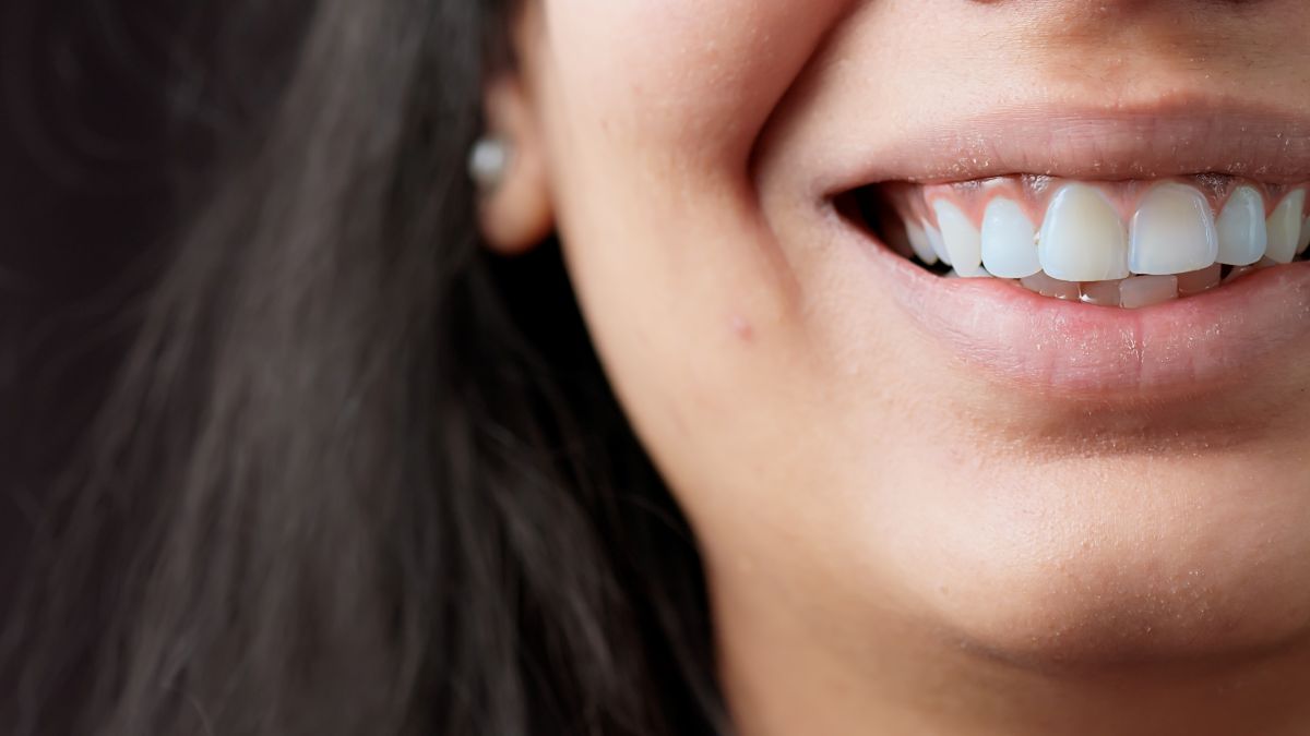 Close-up of a person's smile, showing white teeth and pink lips in a bright, cheerful expression.