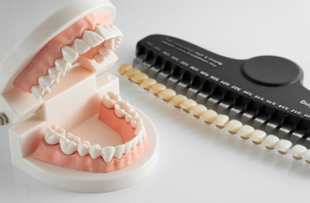 Dental model showing upper and lower teeth with a bite alignment device in the background to study occlusion and alignment.