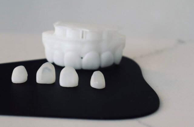 Four small white teeth placed on a black surface with a dental mold in the blurred background.