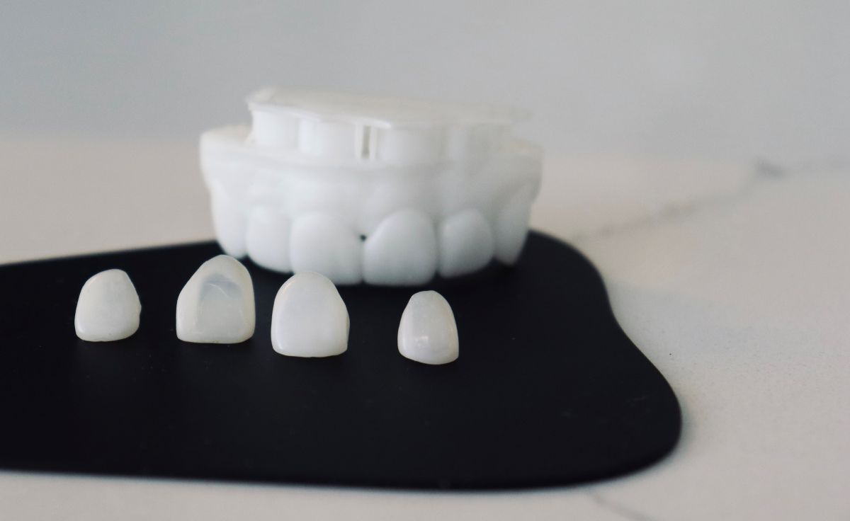 Four small white teeth placed on a black surface with a dental mold in the blurred background.